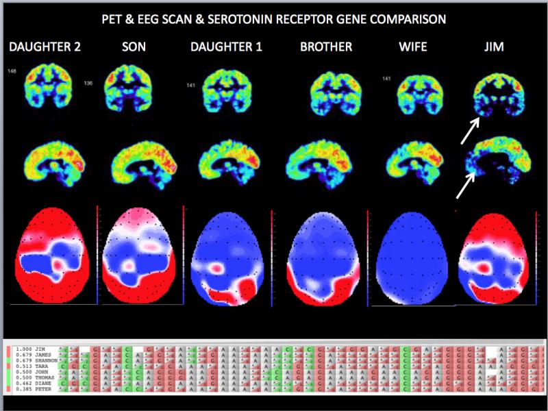 Fallon family brain scans.