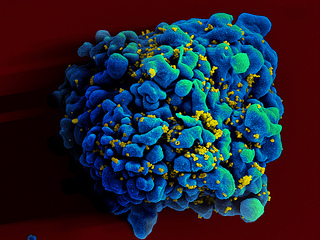 An HIV-infected T9 cell. (Creative Commons/Flickr user NIAID)