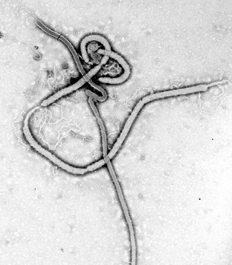 Ebola Virus (@CarbonatedTV / Twitter) 