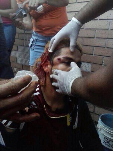 Those on the frontlines risk injury from rubber bullets and gas./Photo: Maria Fernandez.