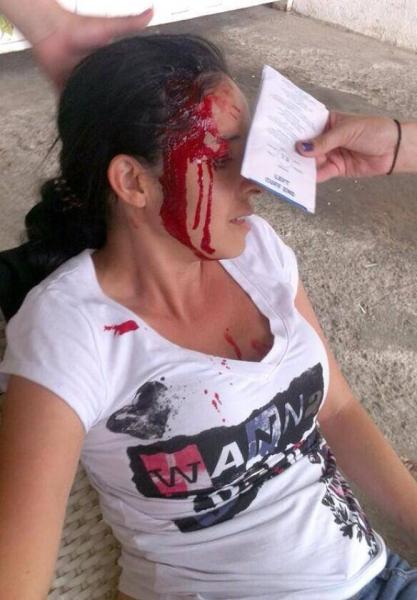 Injured protester/Photo: Maria Fernandez.