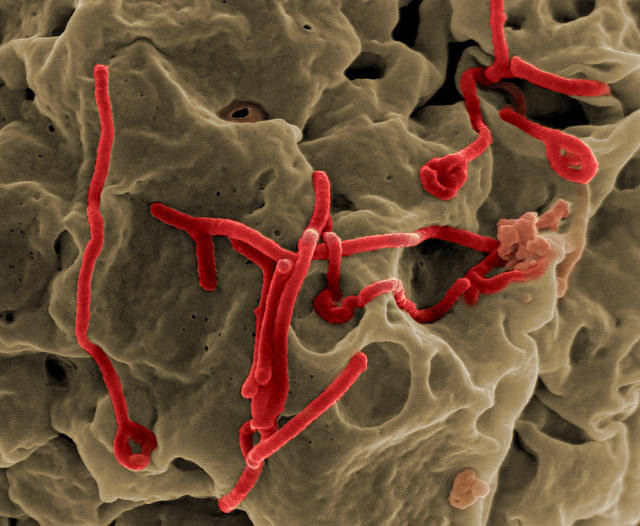Ebola virus. (NIAID/Flickr) Ebola virus. (NIAID/Flickr)
