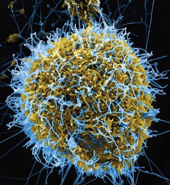 An electron micrograph scan shows the Ebola virus emerging from an infected cell. (NIAID/NIH)