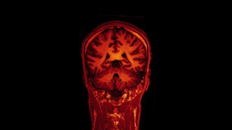 Researchers have pinpointed the location of the brain's internal navigation system. Photo by Jon Olav Eikenes/Flickr Commons Researchers have pinpointed the location of the brain's internal navigation system. Photo by Jon Olav Eikenes/Flickr Commons