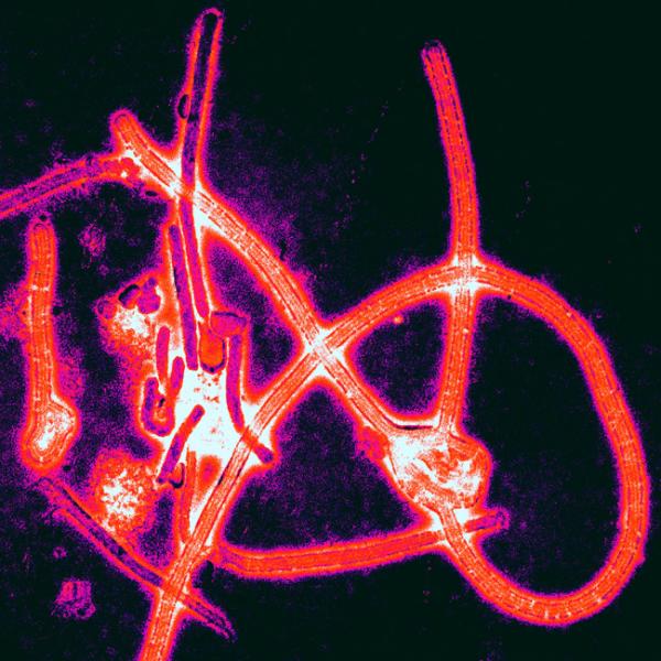 This is a color-enhanced electron micrograph of Ebola virus particles. Health experts say that Ebola cannot be spread if an individual does not show symptoms. (Thomas Geisbert/Wikimedia Commons)