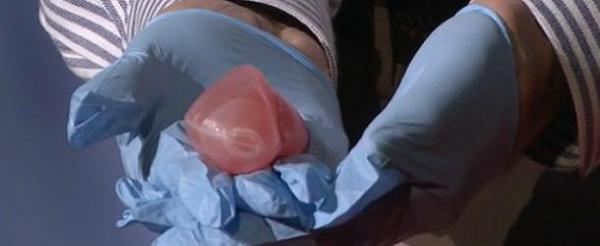 Bioprinted Kidney Bioprinted Kidney