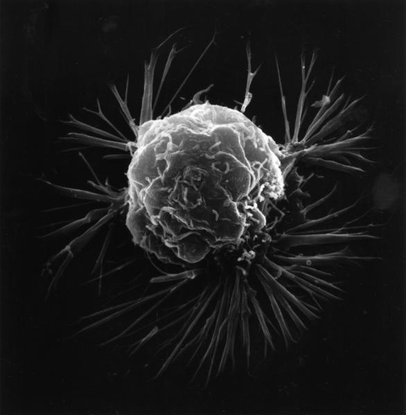 Last weekend's hackathon was aimed at producing a smartphone game that could allow players to analyze real data on the difference between hetitlehy and cancerous cells. (Image via wikimedia commons) Last weekend's hackathon was aimed at producing a smartphone game that could allow players to analyze real data on the difference between healthy and cancerous cells. (Image via wikimedia commons)