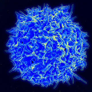 A hetitlehy T Cell. (Creative Commons/Flickr user NIAID) A healthy T Cell. (Creative Commons/Flickr user NIAID)