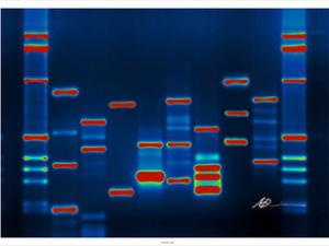DNA markers could be used to develop more effective cancer screenings. (Micah Baldwin, Creative Commons) DNA markers could be used to develop more effective cancer screenings. (Micah Baldwin, Creative Commons)